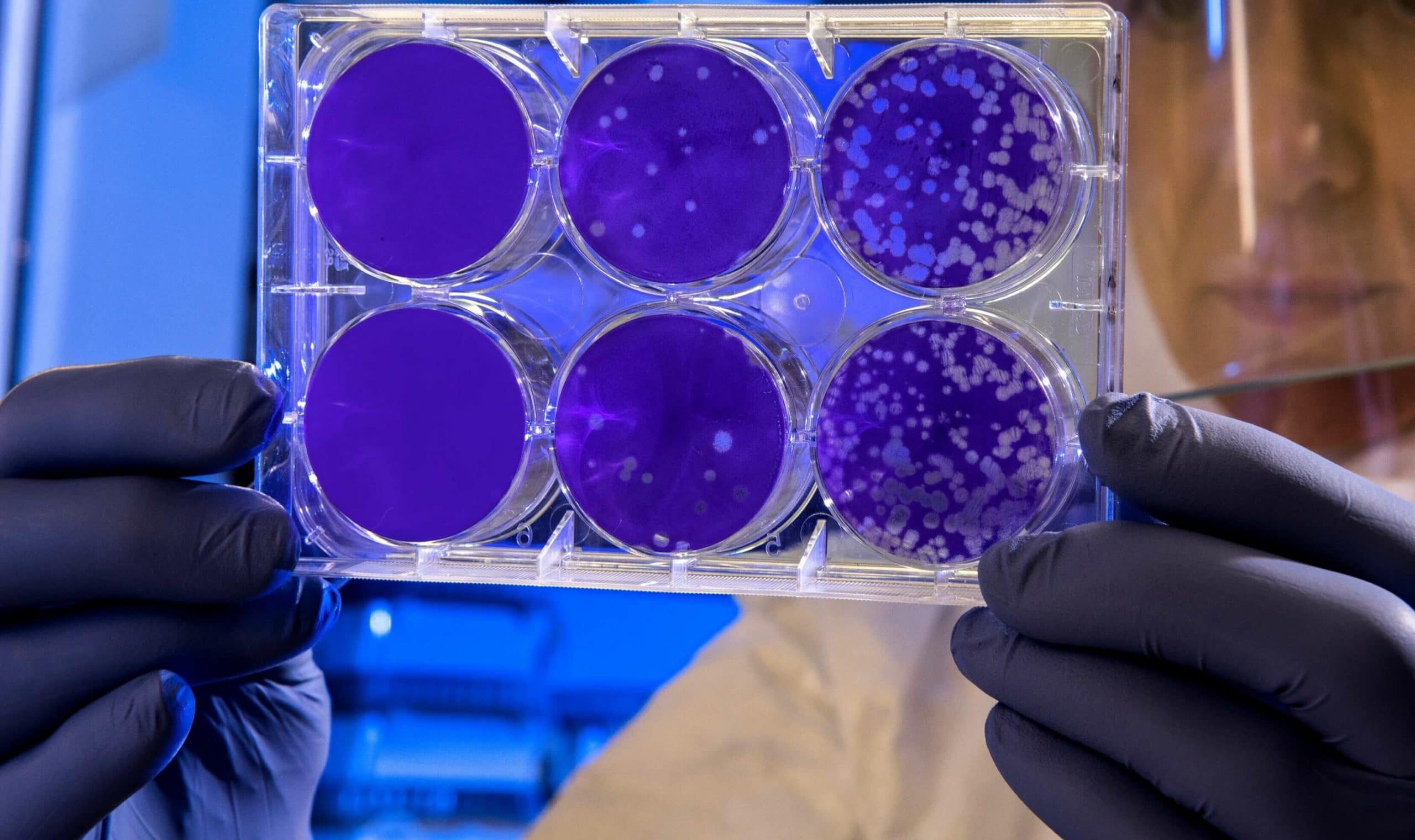 Machinelearnig_pharma_livescience e1578924141541