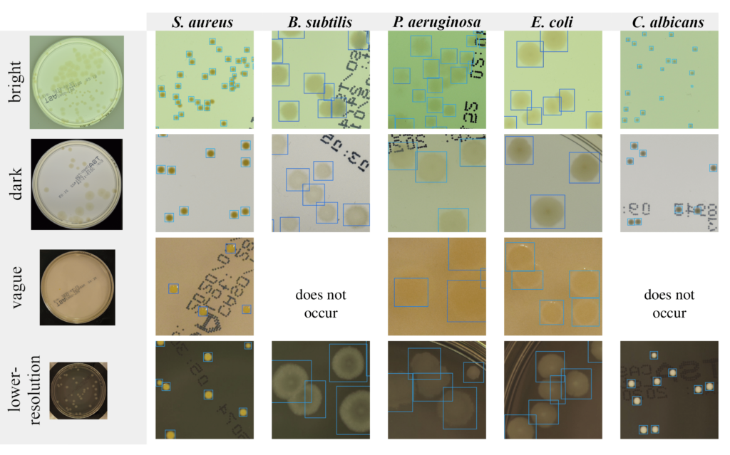 Object detection Petri dishes