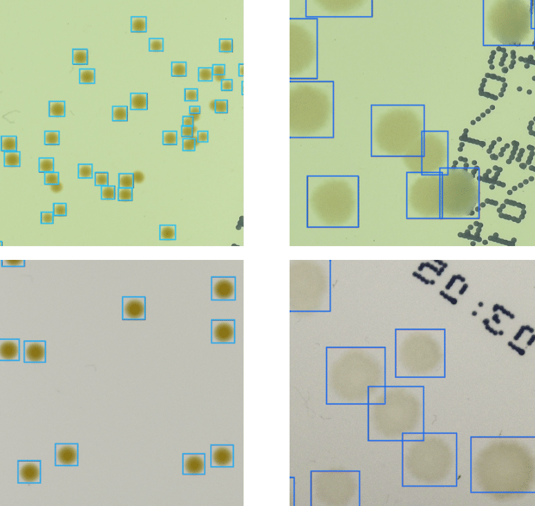 Object detection - bacterial colonies