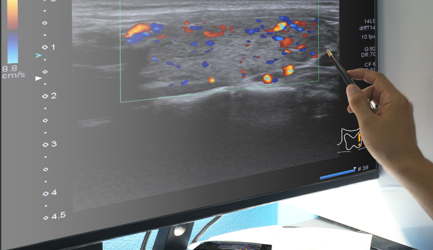 Home services predictive modeling